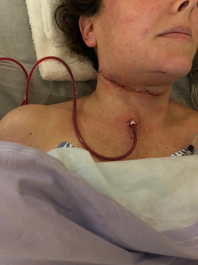 Lane Fights to Survive - 5/17/18 surgery