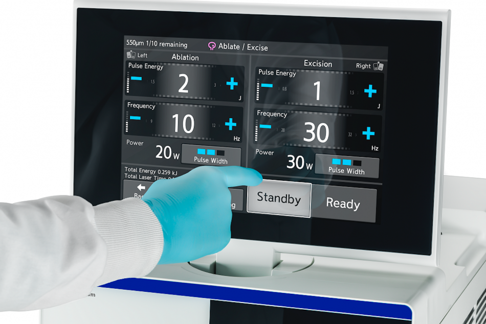 Olympus Soltive SuperPulsed Laser System is now used in urology procedures.