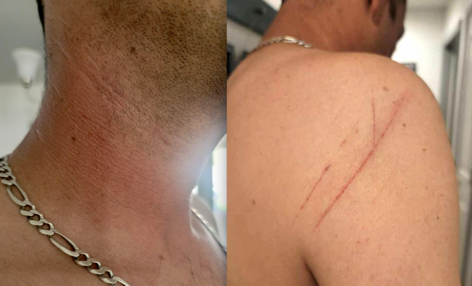 Gorby claims he was the one who was battered by the Public Works employee, not the other way around